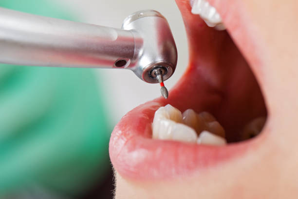 Best Cracked Tooth Emergency Dentist  in Everman, TX
